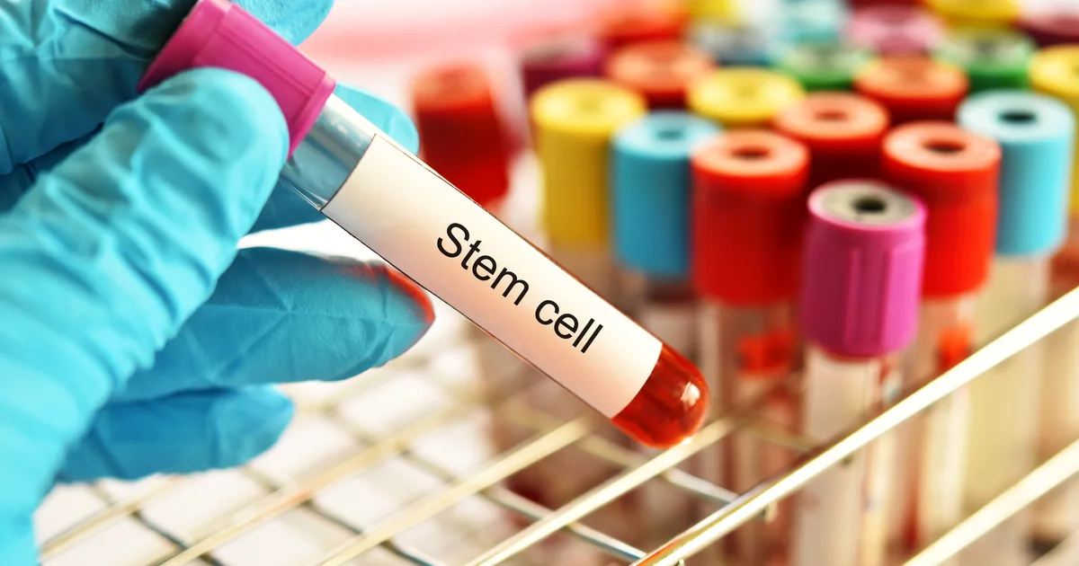 Comparing stem cell IV therapy and PRP regenerative options at iCRYO South Jordan